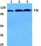 Thrombomodulin antibody, GTX66734, GeneTex, Western Blot image 