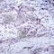 Nuclear Factor Kappa B Subunit 2 antibody, AP0419, ABclonal Technology, Immunohistochemistry paraffin image 