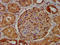 Rab11 family-interacting protein 5 antibody, LS-C672977, Lifespan Biosciences, Immunohistochemistry paraffin image 