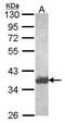 Aldo-Keto Reductase Family 1 Member C4 antibody, GTX114319, GeneTex, Western Blot image 