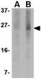 BCL2 Binding Component 3 antibody, GTX84991, GeneTex, Western Blot image 