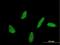 Ubiquitin Conjugating Enzyme E2 U antibody, H00148581-M07, Novus Biologicals, Immunofluorescence image 