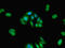 Transmembrane Protein 67 antibody, orb30608, Biorbyt, Immunofluorescence image 