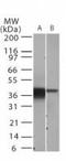 NFKB Inhibitor Alpha antibody, TA336372, Origene, Western Blot image 