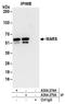 Tryptophanyl-TRNA Synthetase antibody, A304-275A, Bethyl Labs, Immunoprecipitation image 