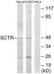 Secretin Receptor antibody, GTX87585, GeneTex, Western Blot image 