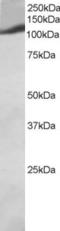 Phosphatidylinositol-4,5-Bisphosphate 3-Kinase Catalytic Subunit Gamma antibody, EB05591, Everest Biotech, Western Blot image 