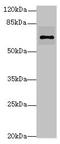 Rho-related BTB domain-containing protein 3 antibody, orb25607, Biorbyt, Western Blot image 