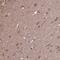 ACOT6 antibody, PA5-63541, Invitrogen Antibodies, Immunohistochemistry frozen image 