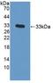 Snail Family Transcriptional Repressor 1 antibody, abx131592, Abbexa, Western Blot image 