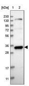 General Transcription Factor IIE Subunit 2 antibody, PA5-55220, Invitrogen Antibodies, Western Blot image 