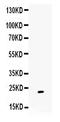 Gremlin 1, DAN Family BMP Antagonist antibody, PB9626, Boster Biological Technology, Western Blot image 