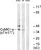 Calcium/calmodulin-dependent protein kinase type 1 antibody, P02576, Boster Biological Technology, Western Blot image 