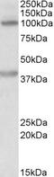 Thioredoxin Domain Containing 5 antibody, 42-430, ProSci, Western Blot image 