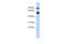BAF Chromatin Remodeling Complex Subunit BCL11A antibody, 25-496, ProSci, Western Blot image 