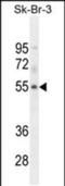 DDB1 And CUL4 Associated Factor 4 Like 1 antibody, PA5-48117, Invitrogen Antibodies, Western Blot image 