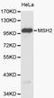 MutS Homolog 2 antibody, LS-C192277, Lifespan Biosciences, Western Blot image 