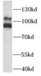 Phospholipase A2 Group IVB antibody, FNab10095, FineTest, Western Blot image 