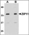 Zinc transporter ZIP11 antibody, orb89229, Biorbyt, Western Blot image 