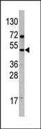 Vascular Endothelial Growth Factor D antibody, 62-227, ProSci, Western Blot image 