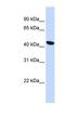 Transmembrane Protein 117 antibody, NBP1-91358, Novus Biologicals, Western Blot image 