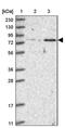 Zinc Finger Protein 526 antibody, PA5-54686, Invitrogen Antibodies, Western Blot image 