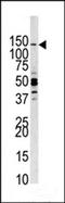 Phosphatidylinositol-4,5-Bisphosphate 3-Kinase Catalytic Subunit Gamma antibody, LS-C100963, Lifespan Biosciences, Western Blot image 