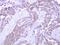 Sorting nexin-33 antibody, GTX119295, GeneTex, Immunohistochemistry paraffin image 