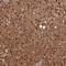 Acid Phosphatase 7, Tartrate Resistant (Putative) antibody, NBP2-48753, Novus Biologicals, Immunohistochemistry frozen image 