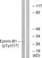 Ephrin B1 antibody, LS-C198901, Lifespan Biosciences, Western Blot image 