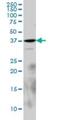 Laforin antibody, H00007957-M02, Novus Biologicals, Western Blot image 