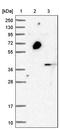 C1GALT1 Specific Chaperone 1 antibody, PA5-53349, Invitrogen Antibodies, Western Blot image 
