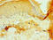 Prolyl 4-Hydroxylase Subunit Alpha 3 antibody, LS-C371598, Lifespan Biosciences, Immunohistochemistry paraffin image 