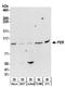 FER Tyrosine Kinase antibody, A304-310A, Bethyl Labs, Western Blot image 