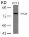 Protein Kinase C Theta antibody, GTX50606, GeneTex, Western Blot image 