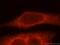 Adaptor Related Protein Complex 2 Subunit Beta 1 antibody, 15690-1-AP, Proteintech Group, Immunofluorescence image 