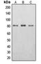 Centrin 1 antibody, orb340872, Biorbyt, Western Blot image 