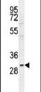 C-Type Lectin Domain Containing 10A antibody, PA5-24058, Invitrogen Antibodies, Western Blot image 