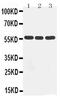 Cytochrome P450 Family 2 Subfamily D Member 6 antibody, PA5-79130, Invitrogen Antibodies, Western Blot image 