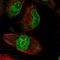 Zinc Finger Protein 749 antibody, HPA042082, Atlas Antibodies, Immunofluorescence image 