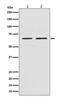 SMAD Family Member 4 antibody, M00074, Boster Biological Technology, Western Blot image 