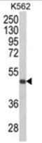 Killer Cell Immunoglobulin Like Receptor, Three Ig Domains And Short Cytoplasmic Tail 1 antibody, AP18085PU-N, Origene, Western Blot image 