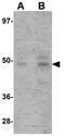 Lysine Demethylase 8 antibody, GTX85251, GeneTex, Western Blot image 
