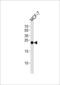 Glutathione S-Transferase Mu 4 antibody, PA5-49332, Invitrogen Antibodies, Western Blot image 