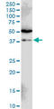 Siah E3 Ubiquitin Protein Ligase 1 antibody, LS-C198194, Lifespan Biosciences, Western Blot image 