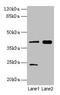 Mitogen-Activated Protein Kinase Kinase 3 antibody, CSB-PA013412LA01HU, Cusabio, Western Blot image 