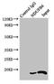 NADH:Ubiquinone Oxidoreductase Subunit B6 antibody, LS-C396856, Lifespan Biosciences, Immunoprecipitation image 