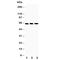 TNF Receptor Superfamily Member 11a antibody, R30453, NSJ Bioreagents, Western Blot image 