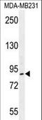 Lysine Acetyltransferase 2B antibody, LS-C163404, Lifespan Biosciences, Western Blot image 