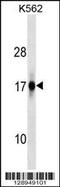 Zinc Finger AN1-Type Containing 2A antibody, 59-607, ProSci, Western Blot image 